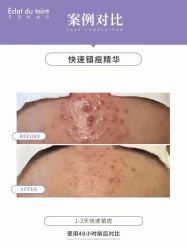 -LUNA皮相美·骨相美高级美感