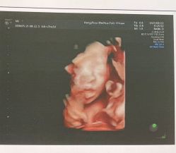 -杭州贝瑞斯美华妇儿医院·早孕·产检·儿科