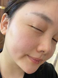 -长沙雅美医疗美容医院