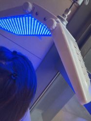 -碧莲盛·不剃发植发