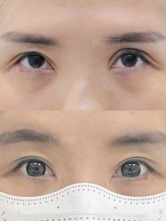 -丰联丽格医疗美容·联合丽格眼整形中心