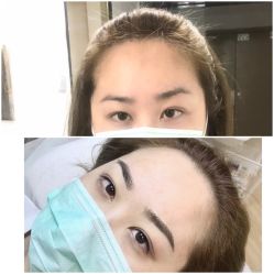-Doris多里斯半永久纹眉·SMP纹发·发际线