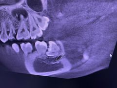 -土豆口腔(凤凰北总店)