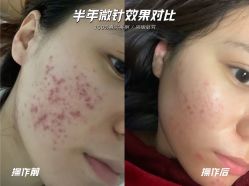 -Cream88颜皮肤管理中心