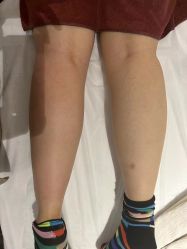 -Lily纤美·科技减脂中心