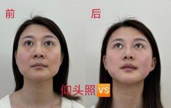 -Yestar艺星医疗美容医院