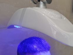 -碧莲盛·不剃发植发