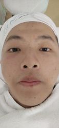 -痘院长·祛痘·皮肤管理
