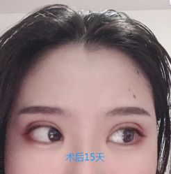-成都西区医院整形美容