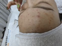 -痘院长·祛痘·科技美肤