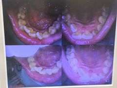 -爱牙联合口腔(门诊报销 海云庵店)