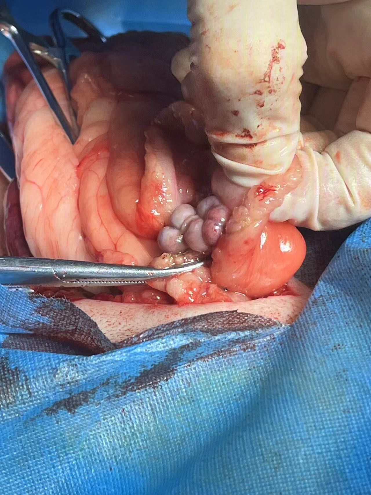 女性金毛结扎的重要‼️