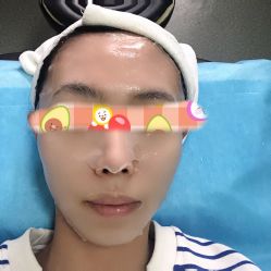 体验后-北京丽星翼美医疗美容