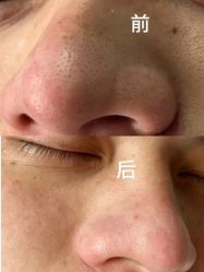 -痘庄科学祛痘国际连锁