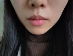-长沙雅美医疗美容医院