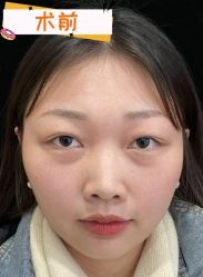 -素美医疗美容·西南眼鼻整形·修复基地