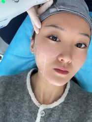 体验前-繁星轻医美连锁