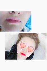 点击看大图 -西施无菌半永久纹绣眉眼影唇轻增发纹发际线