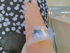 -重庆医科大学附属第一医院(本部)