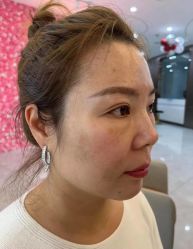 -天津健丽·去眼袋医疗美容机构