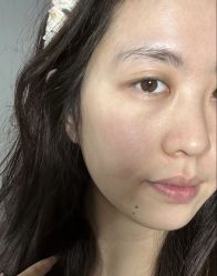 -Yestar艺星整形美容医院