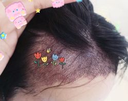 -大麦微针植发全国连锁