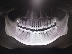 -上海市杨浦区牙病防治所