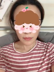体验前-北京楚诺医疗美容