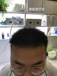 点击看大图 -大麦微针植发全国连锁