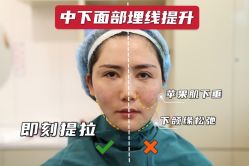 -上海时光整形外科医院