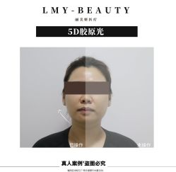 -丽美妍医疗美容·皮秒·立体分层抗衰
