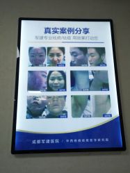 -成都军建医院·疤痕诊疗中心