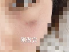 -杭州仁易堂中医康复医院疤痕修复