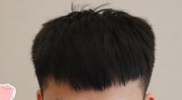 -大麦微针植发丨全国连锁