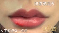 -OnFaer.纹眉半永久无创洗眉