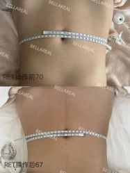 -BELLAREAL新美社