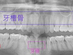 -团圆口腔·种植中心(锦江院区)