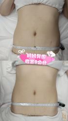 -Lily纤美·科技减脂中心
