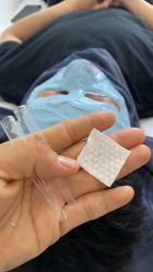 -瑶芳清颜草本祛痘