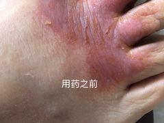 -中国人民解放军总医院