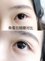 -MIVI半永久纹眉纹绣