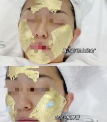 -skin79皮肤管理中心