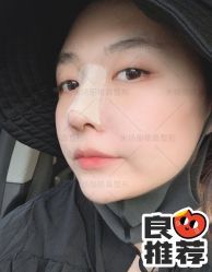 体验后-北京米扬丽格医疗美容·联合丽格鼻整形中心