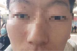 -痣斑堂·取大痣