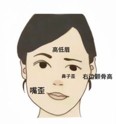 -小颜秘家·韩国整骨