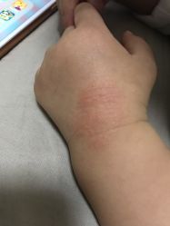 -首都儿科研究所附属儿童医院