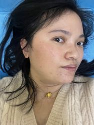 -伊丽莎白医疗美容