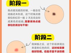 -上海皮肤专科医院