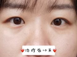 -铂诗玥医美