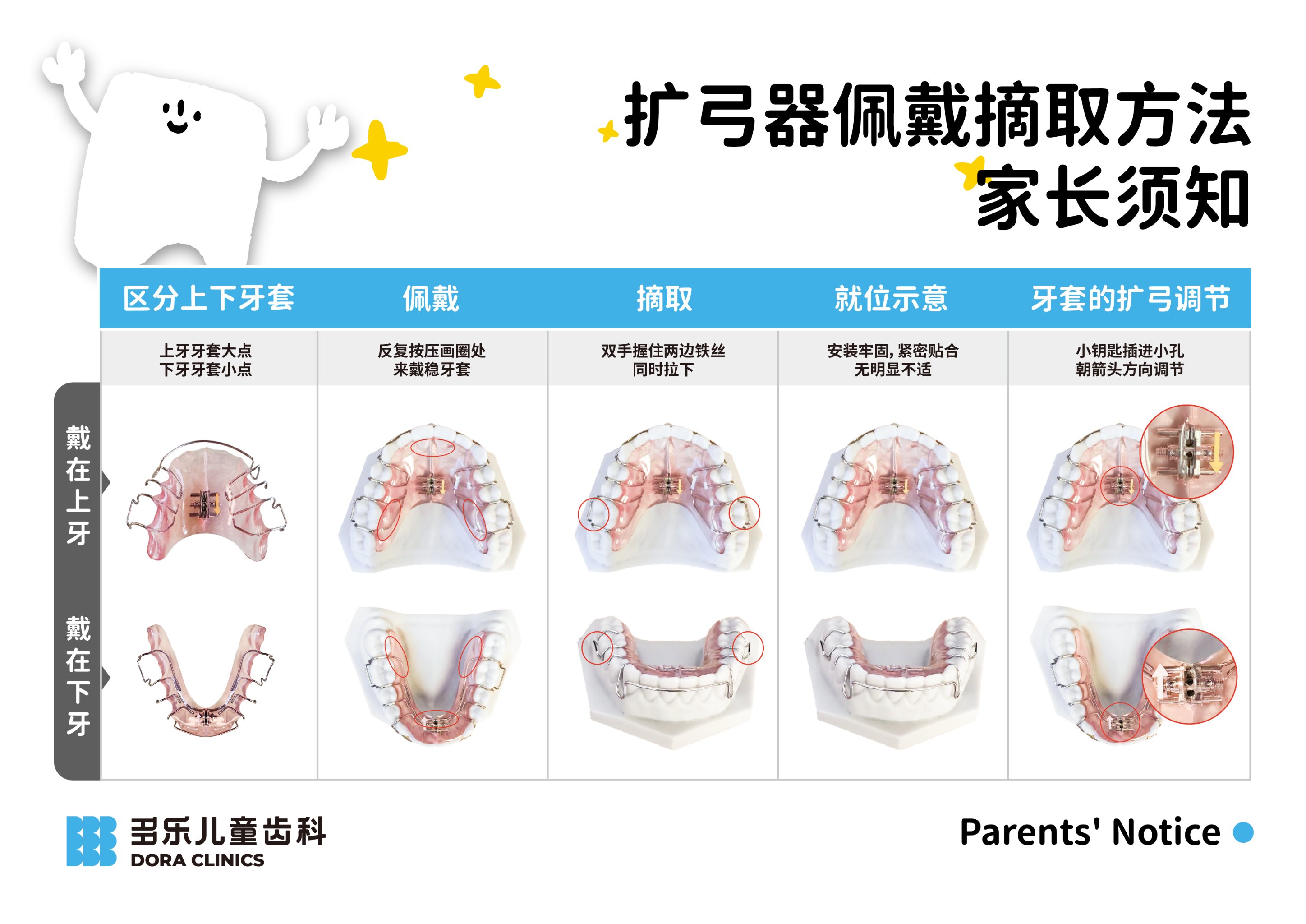 导弓式矫治器适应症图片